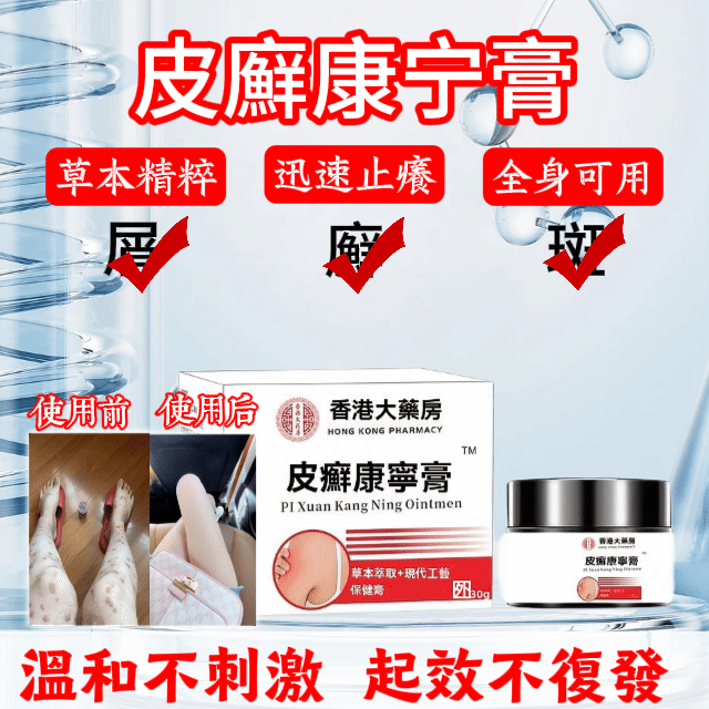 草本溫養|皮癬康寧膏】🌿🦵 皮膚紅癢脫屑、反覆發作抓不停? 「皮癬康宁膏」以多種草本萃取為基底,溫和舒緩、抑制真菌,幫助肌膚恢復清爽健康! 草本溫養|皮癬康寧膏】🌿🦵 皮膚紅癢脫屑、反覆發作抓不停? 「皮癬康宁膏」以多種草本萃取為基底,溫和舒緩、抑制真菌,幫助肌膚恢復清爽健康!